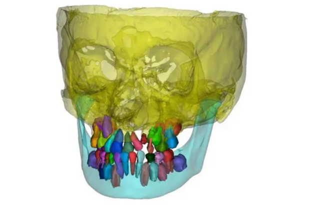 有限元分析：工程设计的幕后 “军师”，仿真环节的关键利刃
